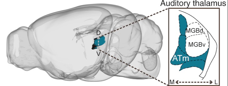 20230808-听觉丘脑冠切示意图-苑克鑫-科研成果.png